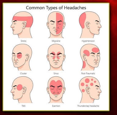Headache - Migraine (தலைவலி  - ஒற்றைத் தலைவலி)
