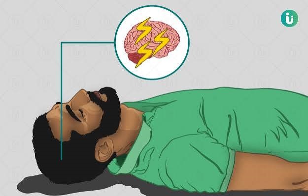 Seizures (Fits) and Epilepsy - வலிப்பு